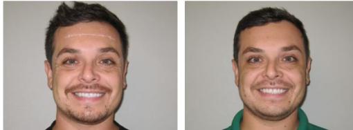 Weight loss Valley medical