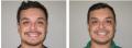 Weight loss Valley medical